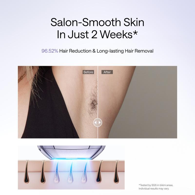SilkPulse Pro